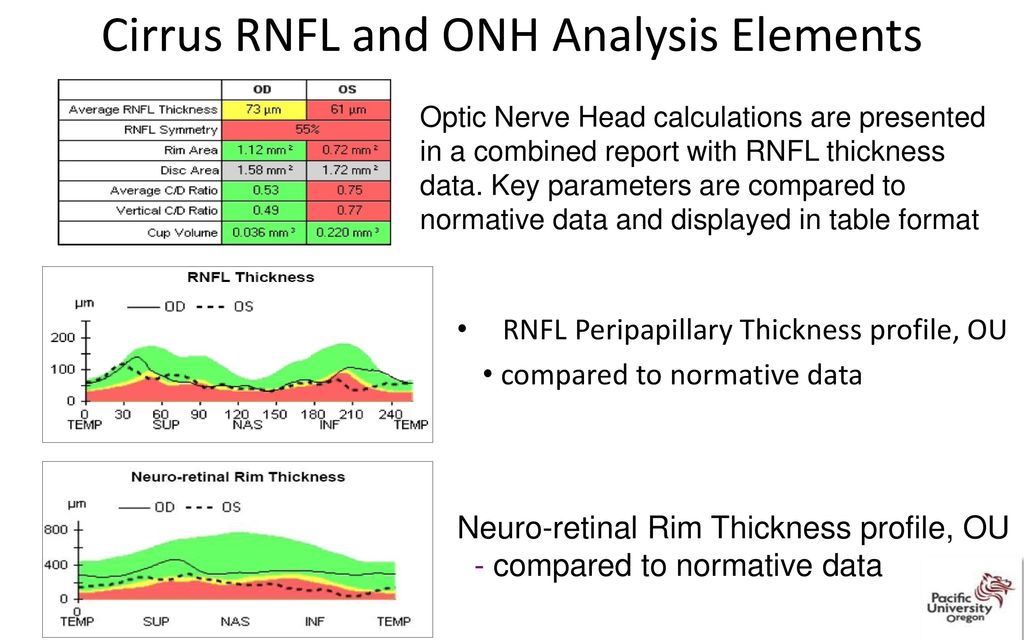 Imaging interpretation for the comprehensive eye care professional