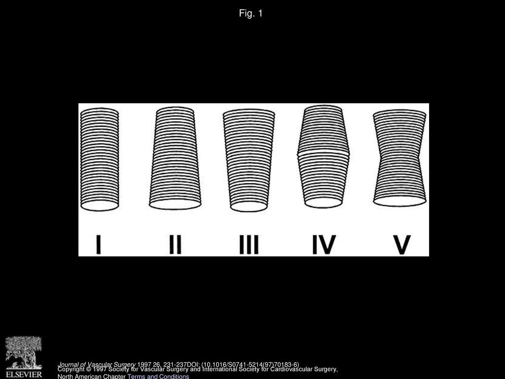 Fig. 1 Classification of the neck configuration in five categories.
