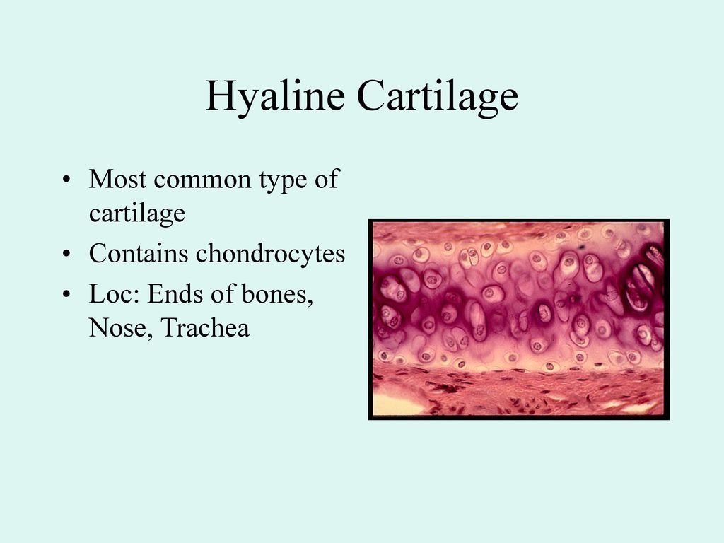 Hyaline Cartilage Most common type of cartilage Contains chondrocytes