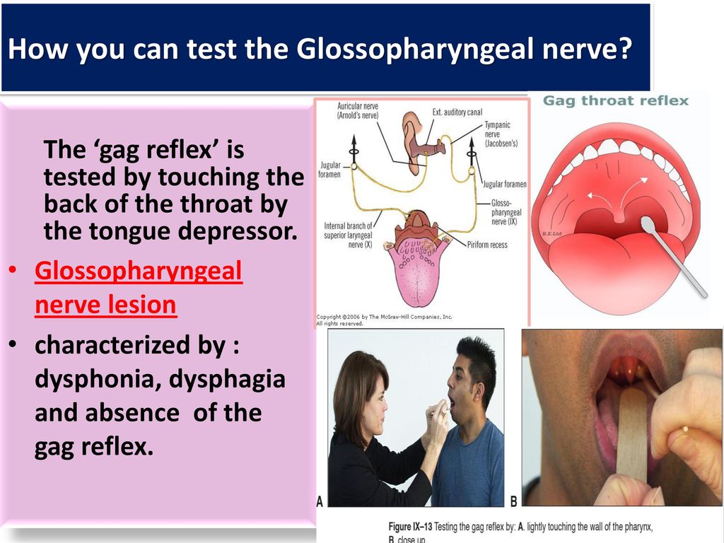 The 'gag reflex' is tested by touching the back of the throat by ...