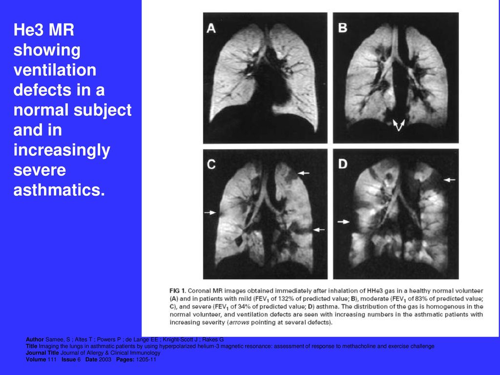 respiratory-problems-in-the-ob-pacu-ppt-download
