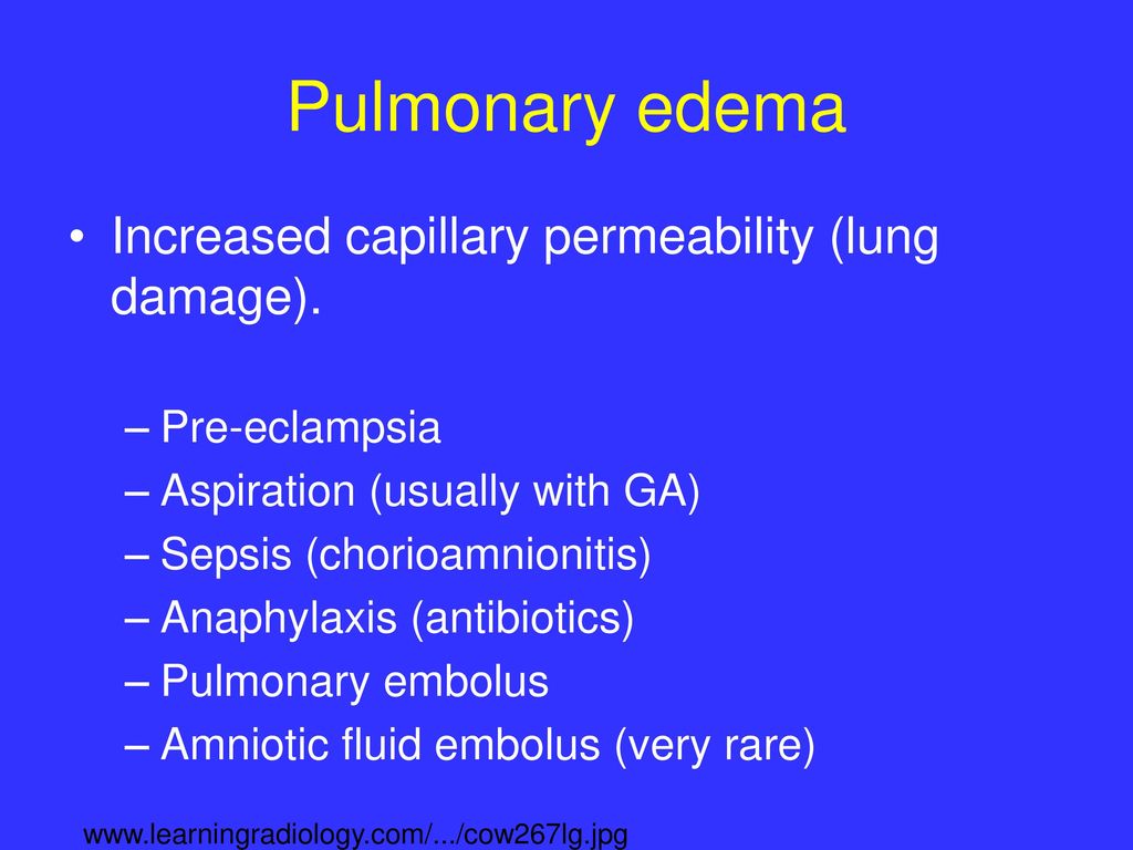 respiratory-problems-in-the-ob-pacu-ppt-download