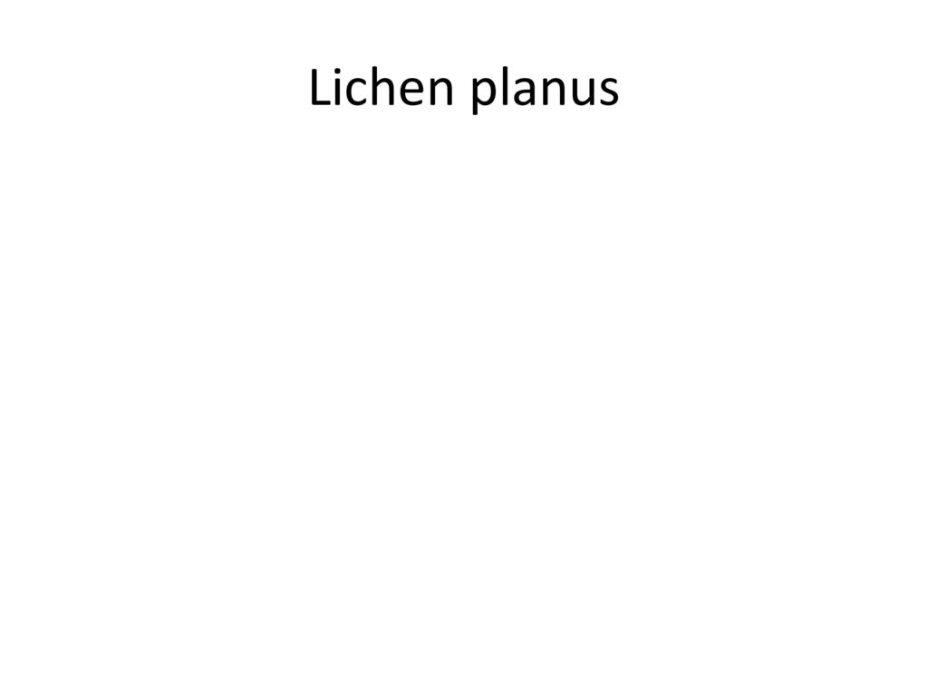 Lichen planus