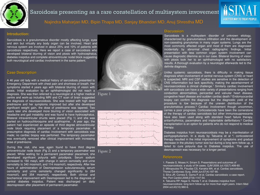 Saroidosis Presenting As A Rare Constellation Of Multisystem Invovement saroidosis-presenting-as-a-rare-constellation-of-multisystem-invovement