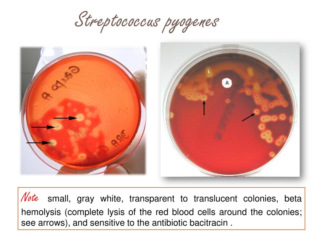 szájszag a streptococcus miatt