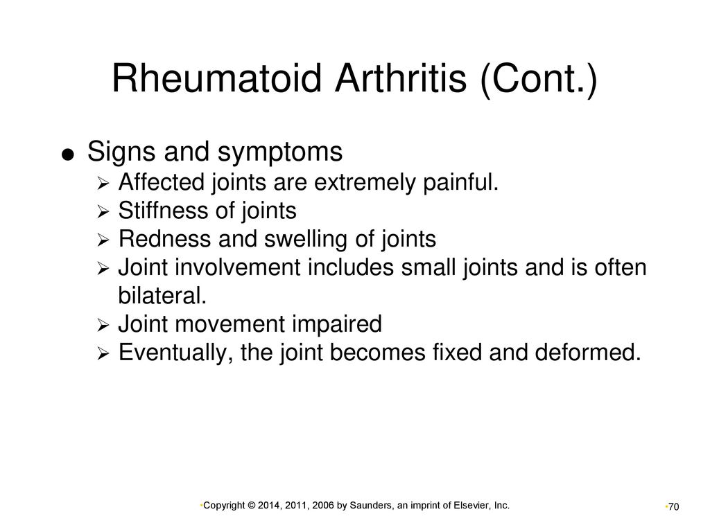 Musculoskeletal System Disorders - ppt download