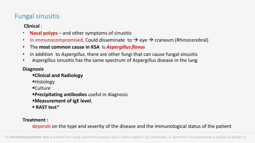 Fungal sinusitis Clinical :