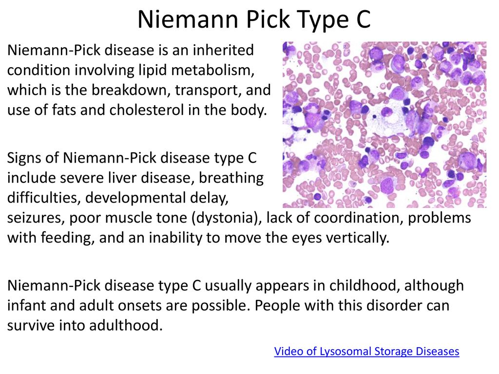 Niemann-Pick type C disease is associated with mtDNA disorganization.