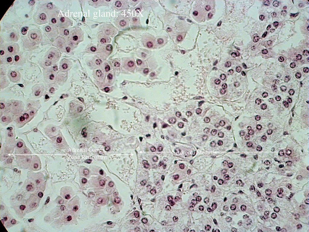 Adrenal gland: 450X Adrenal Cortex Zona Reticularis Adrenal Medulla