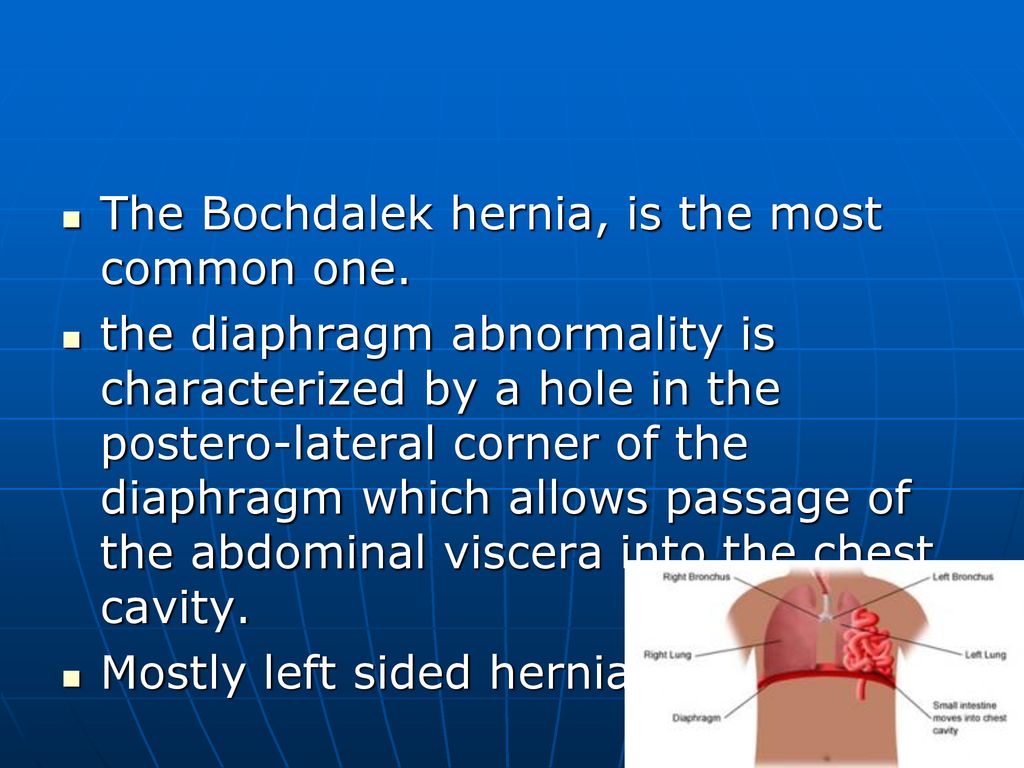 Surgical conditions of the esophagus diaphragmatic hernias ppt download