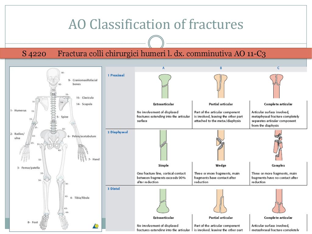 Fractures. - ppt download