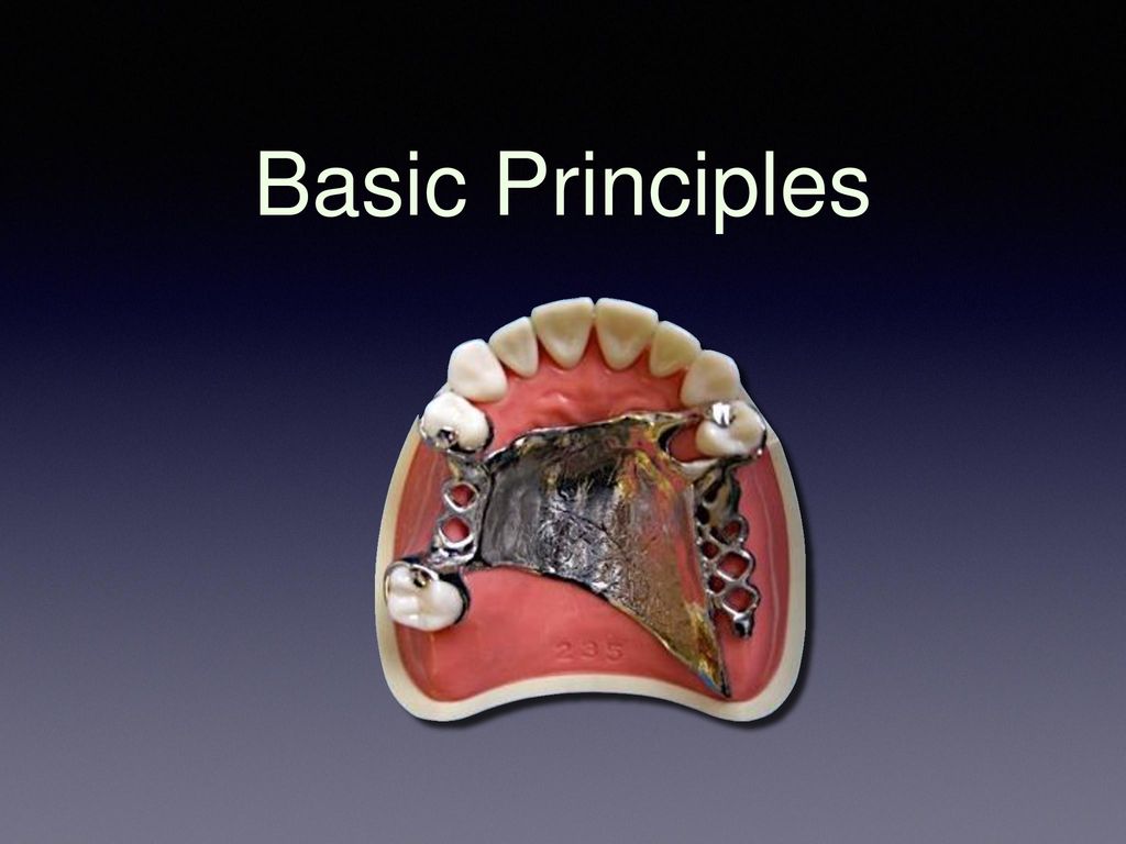 principles of removable partial denture design dalhousie removable partial denture design