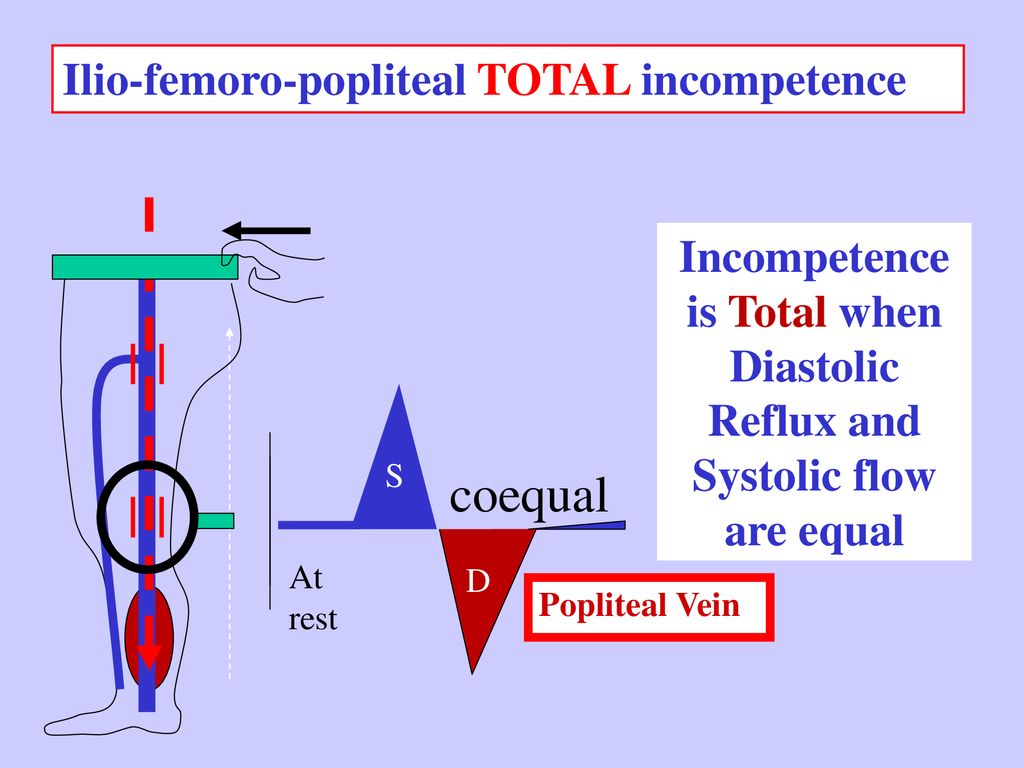 Duplex Assessment of Venous Hemodynamics - ppt download