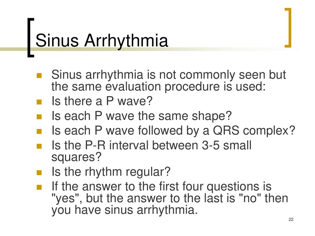 Basic Dysrhythmias Sinus Arrhythmias Ppt Download