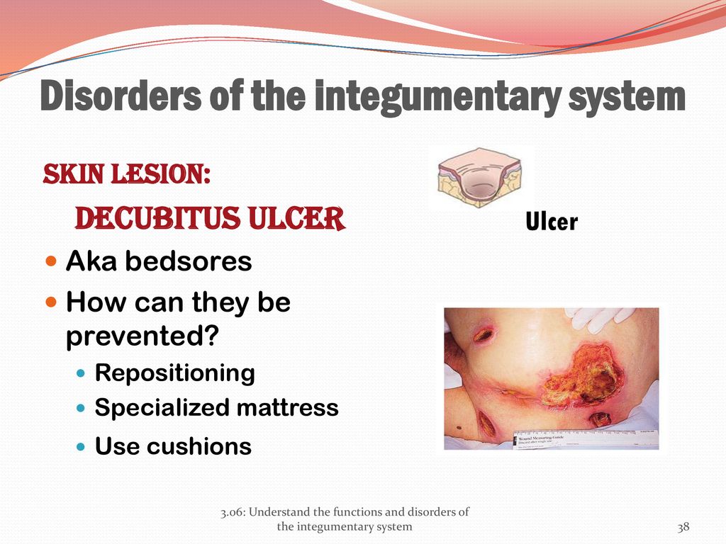 Disorders of the integumentary system