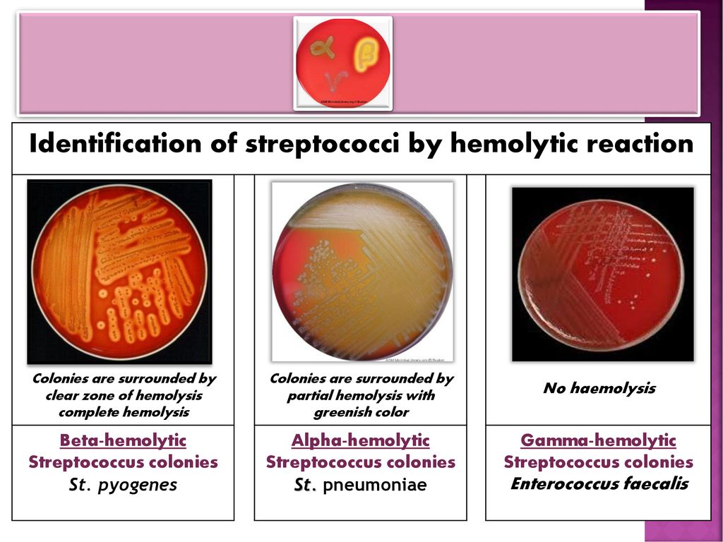 Тест стрептококк группы а. Гамма стрептококки. Гамма стрептококки на кровяном агаре образуют. Стрептококки на кровяном агаре микробиология. Энтерококки на кровяном агаре.