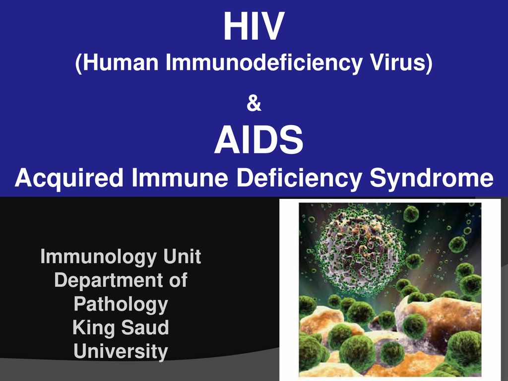 Human immunodeficiency. Aid. Иммунология. Immunodeficiency.