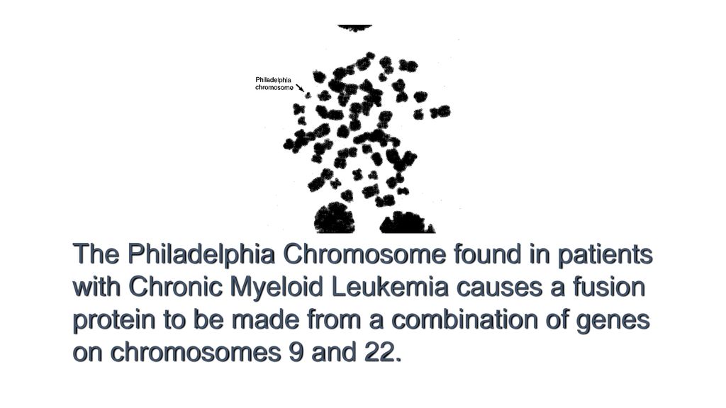 The Philadelphia Chromosome found in patients with Chronic Myeloid Leukemia causes a fusion protein to be made from a combination of genes on chromosomes 9 and 22.