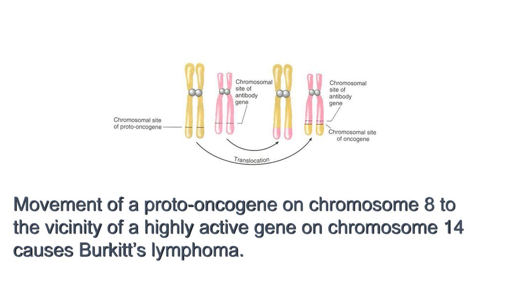 Movement of a proto-oncogene on chromosome 8 to the vicinity of a highly active gene on chromosome 14 causes Burkitt’s lymphoma.