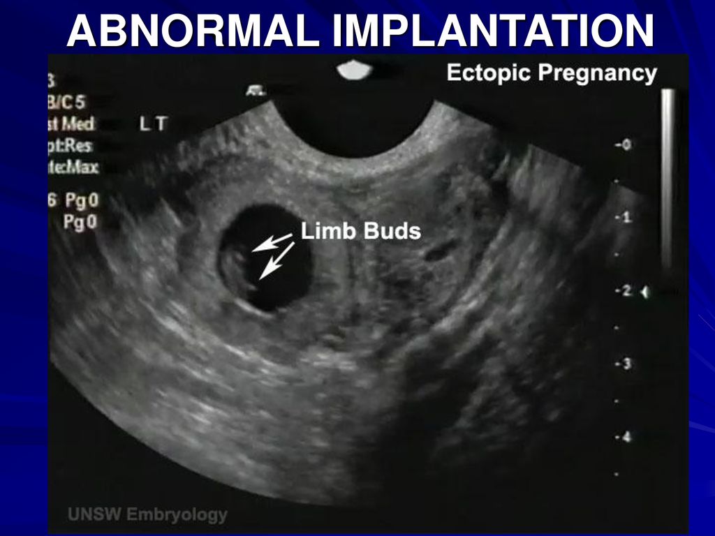 Second Week of Development: Bilaminar Germ Disc - ppt download