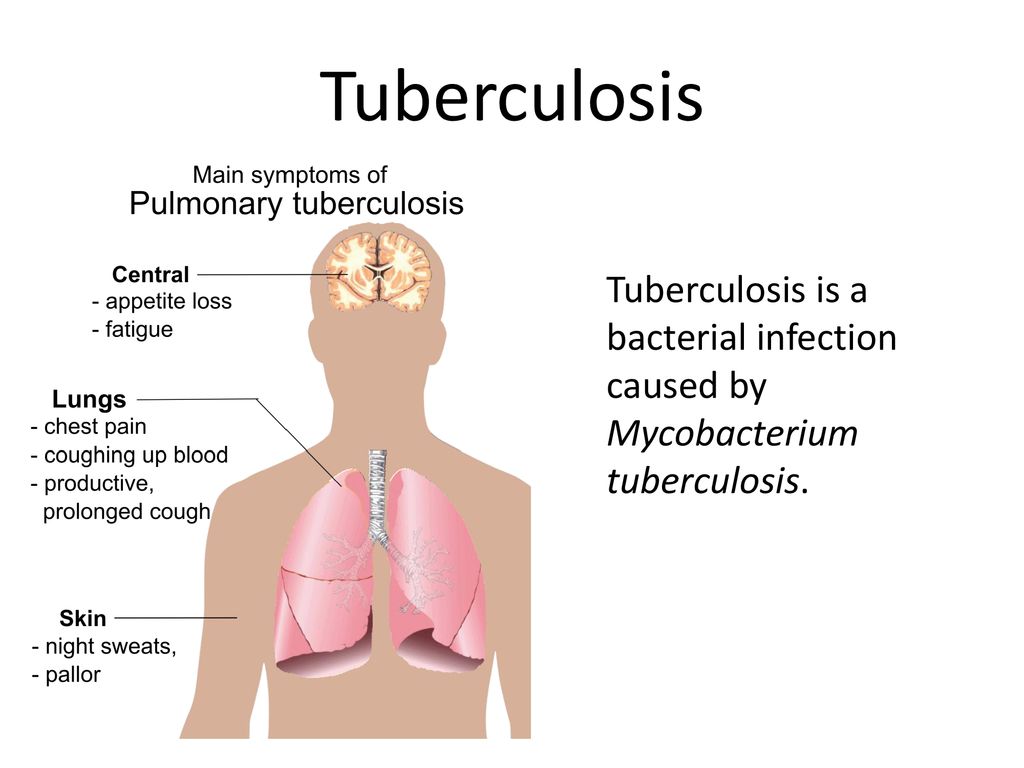 Tuberculosis Tuberculosis is a bacterial infection caused by Mycobacterium tuberculosis.
