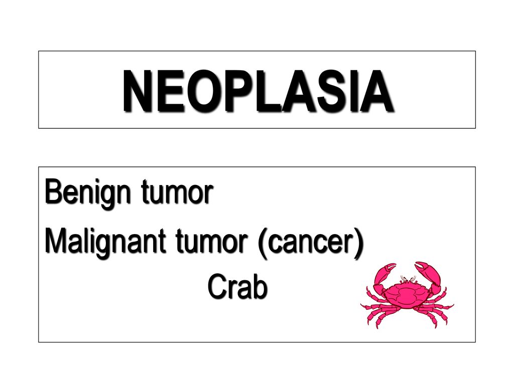 Neoplasm – cauze, simptome și tipuri - Cancer