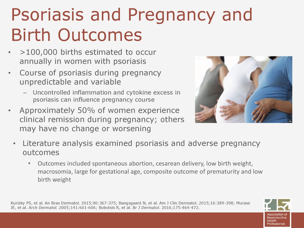psoriasis and pregnancy outcome