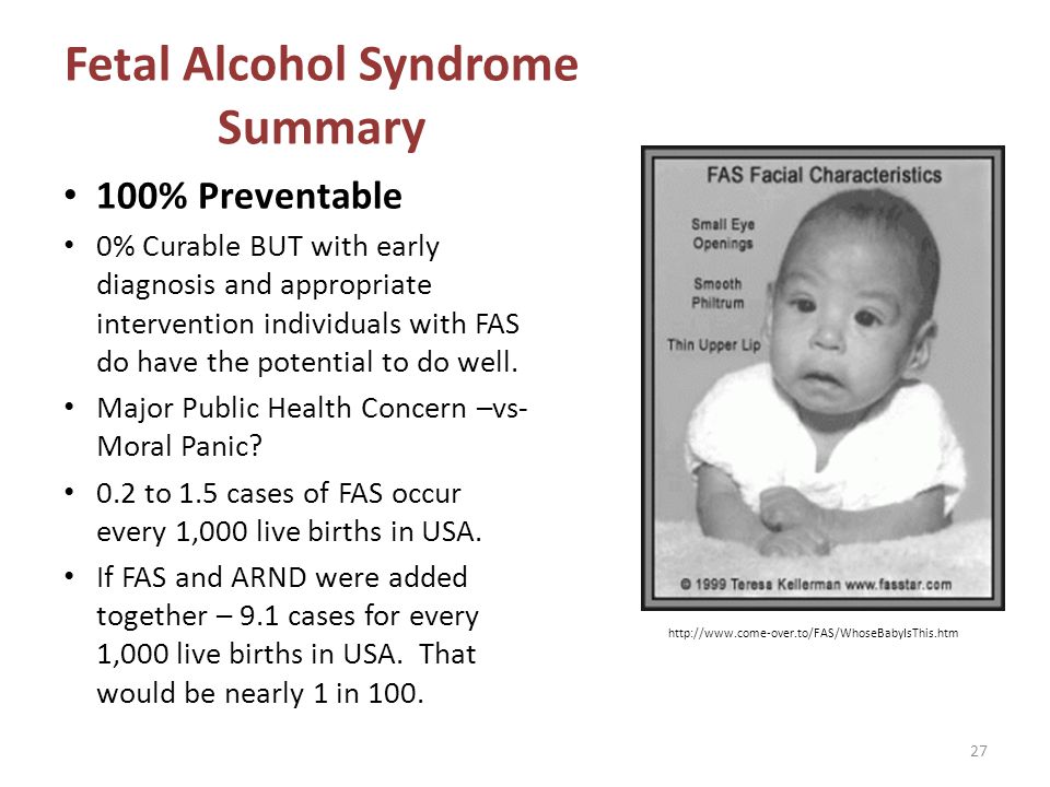 Fetal Alcohol Syndrome Summary.