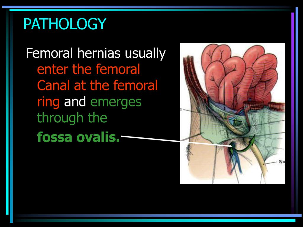 Femoral sheath Anatomy Animation : USMLE Step 1 Review - YouTube