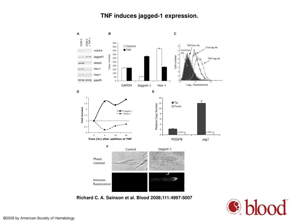 TNF induces jagged-1 expression.
