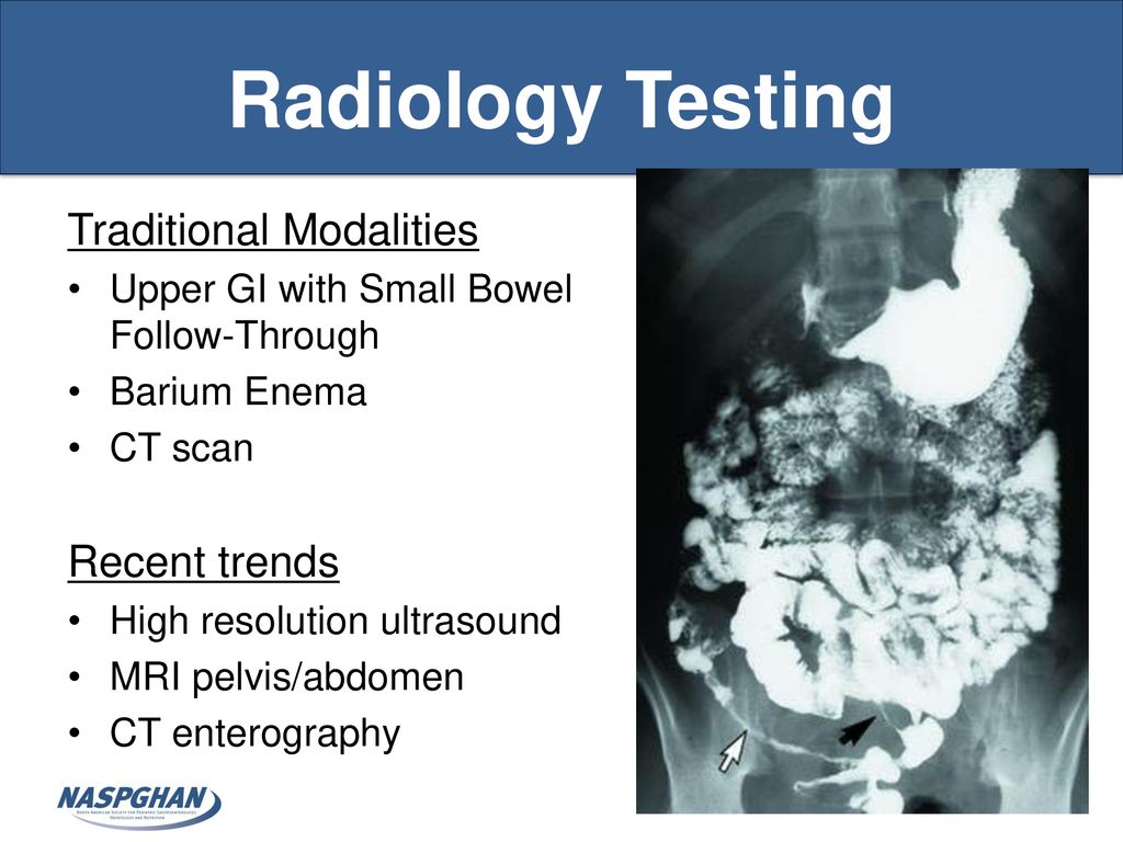 Radiology Testing Traditional Modalities Recent trends
