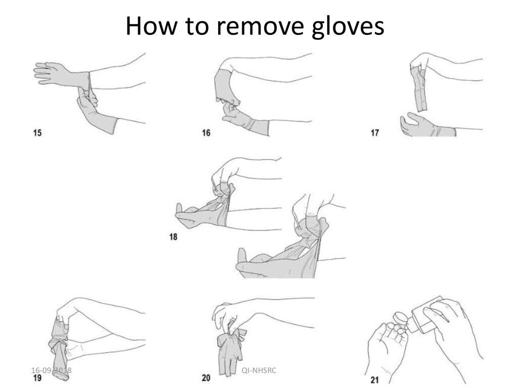 Алгоритм стерильных перчаток. Схема надевания стерильных перчаток. Техника надевания стерильных перчаток. Снятие стерильных перчаток алгоритм. Одевание перчаток медицинских алгоритм.