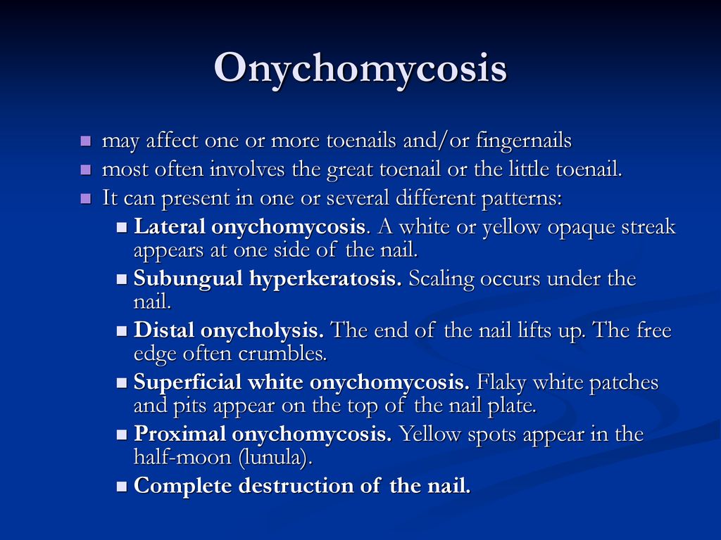 Onychomycosis may affect one or more toenails and/or fingernails