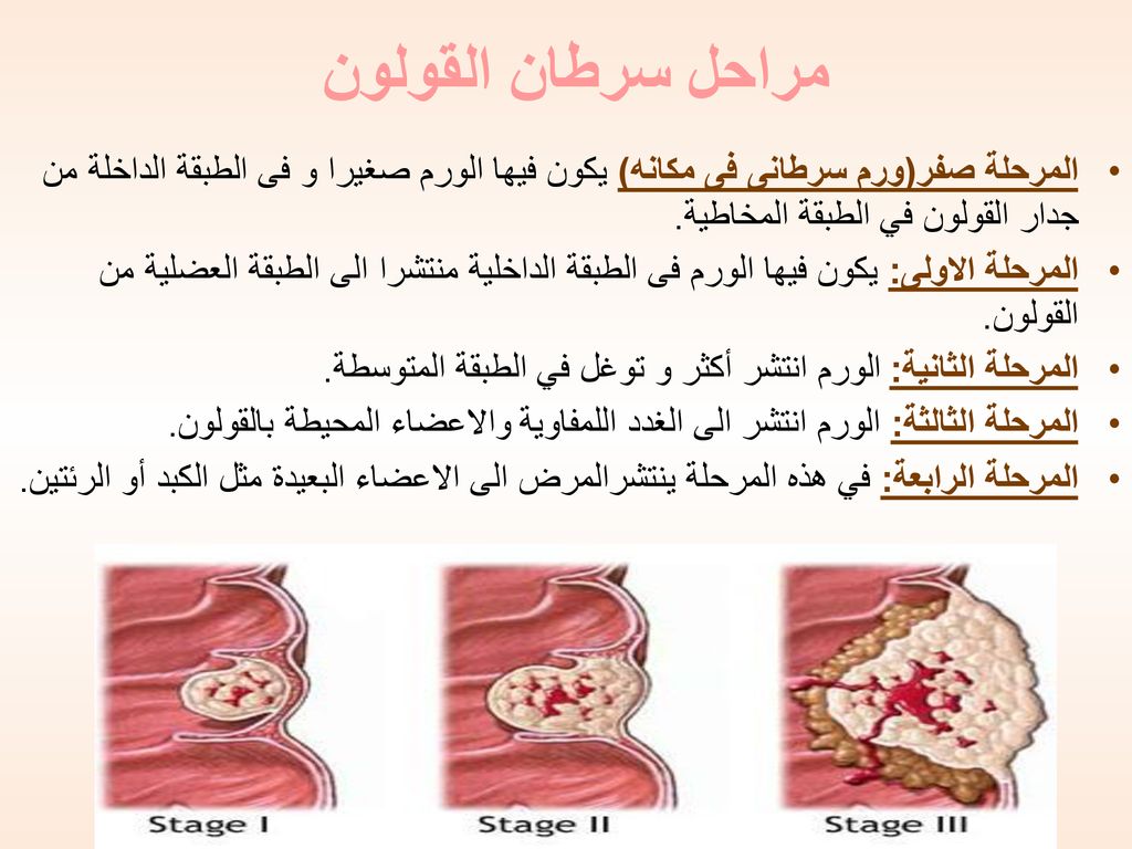 إعداد د مها حسن عبدالعزيز داغستاني أ خلود محمد الحمودي Ppt Download