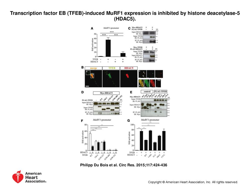 Transcription factor EB (TFEB)-induced MuRF1 expression is inhibited by histone deacetylase-5 (HDAC5).
