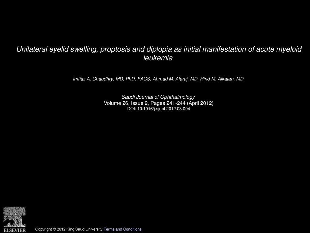 Unilateral Eyelid Swelling Proptosis And Diplopia As Initial Manifestation Of Acute Myeloid 