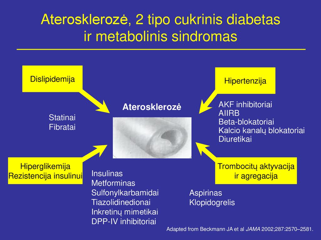 statinai nuo 2 tipo cukrinio diabeto ir hipertenzijos