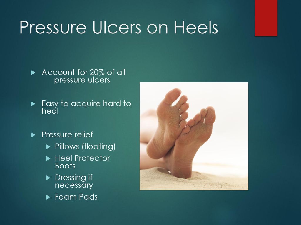 Wound Series Part 3: Pressure Ulcers and Injuries-Risk Factors, Diagnosis,  Staging, Management