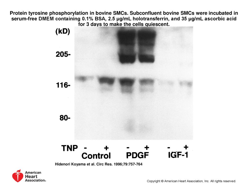 Protein tyrosine phosphorylation in bovine SMCs