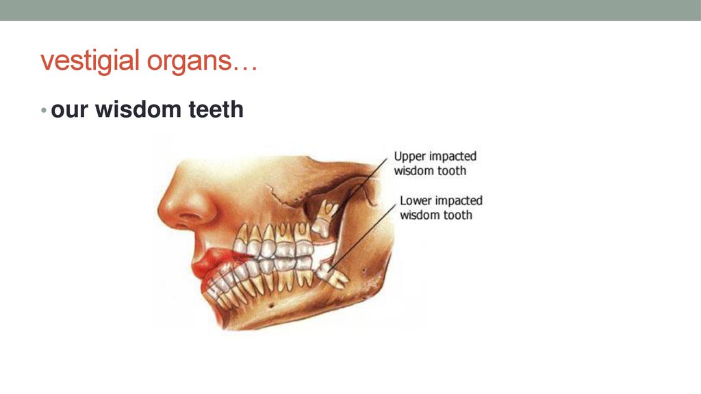 vestigial organs… our wisdom teeth