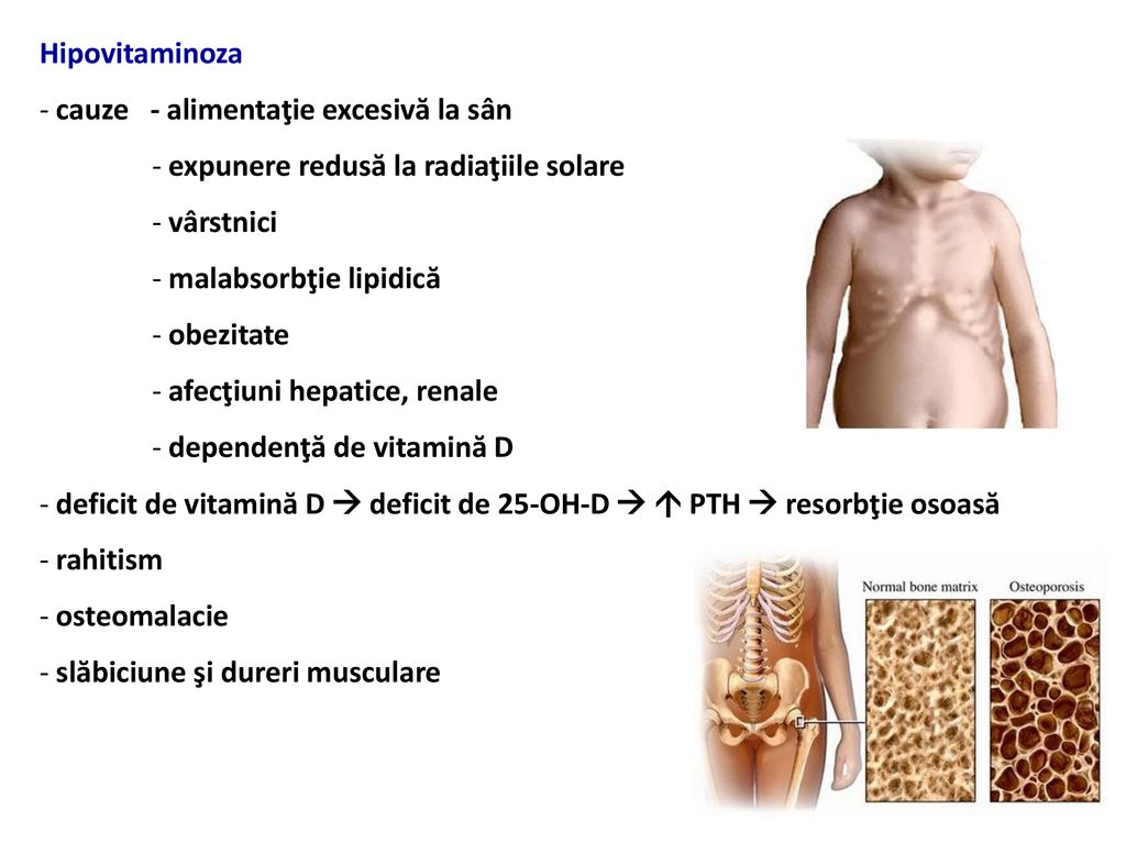 durere articulară hipervitaminoză vitamina A