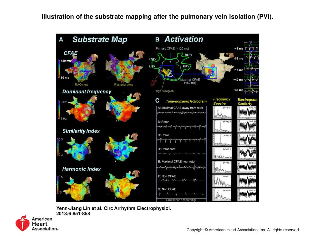 Illustration of the substrate mapping after the pulmonary vein isolation (PVI).