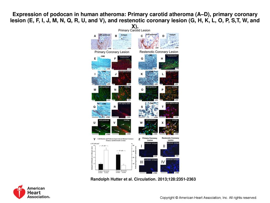 Novel Small Leucine Rich Repeat Protein Podocan Is A Negative Regulator Of Migration And Proliferation Of Smooth Muscle Cells Modulates Neointima Formation Ppt Download
