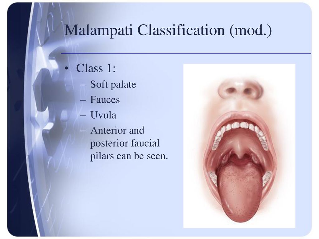 Timothy Sauvage CRNA, MS, ARNP - ppt download