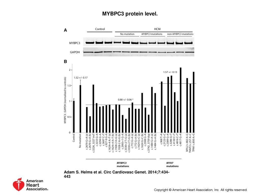 MYBPC3 protein level.