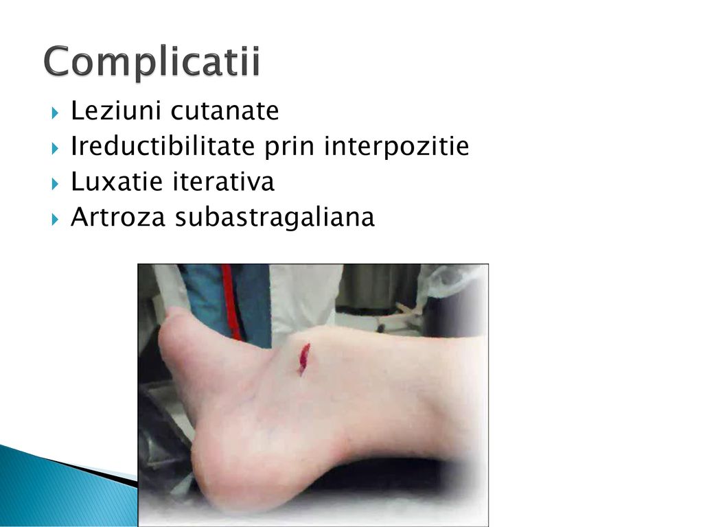 Artroza genunchi - secțiunea 2