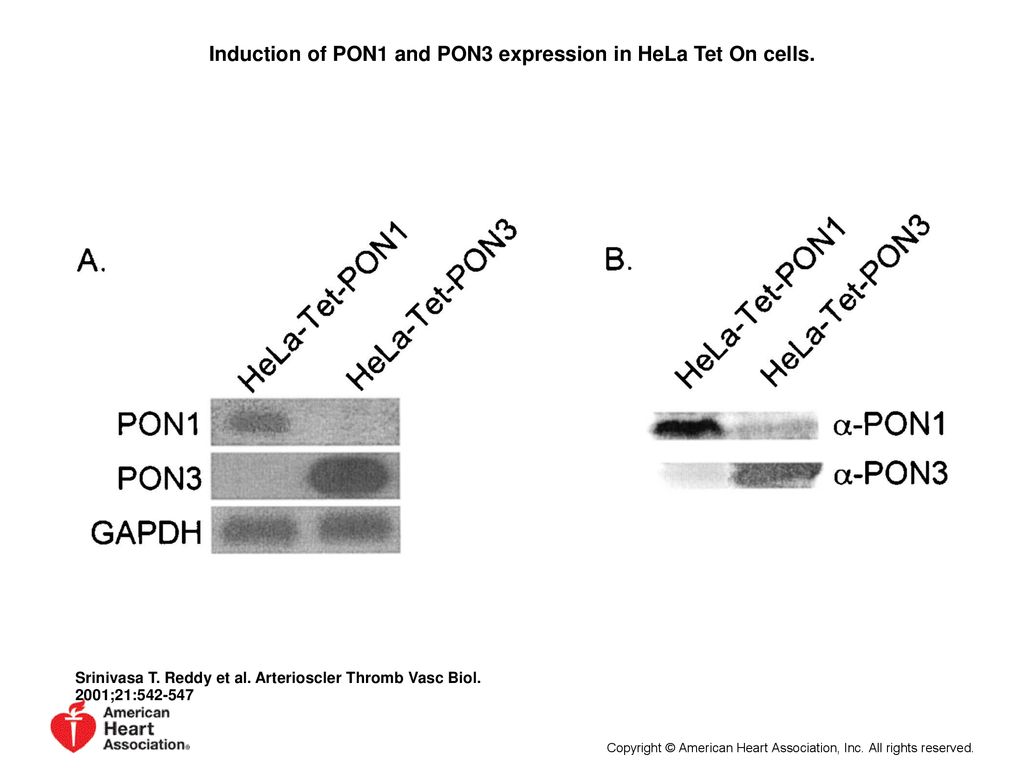 Induction of PON1 and PON3 expression in HeLa Tet On cells.