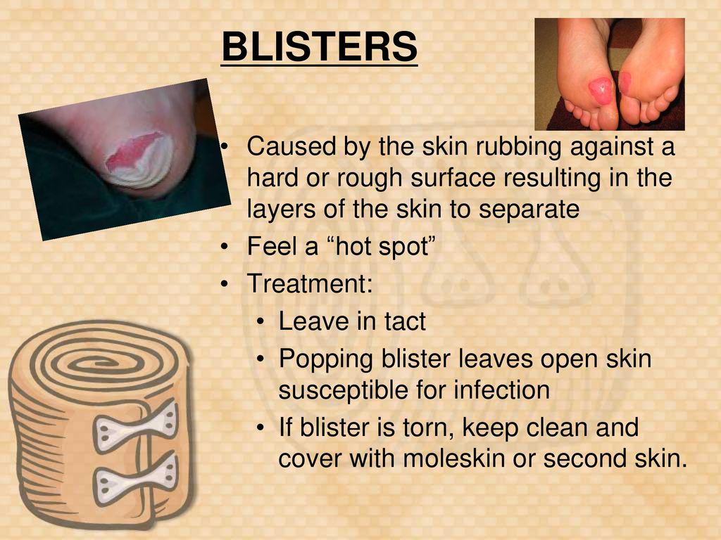 Unit 7 Injury Management. ppt download