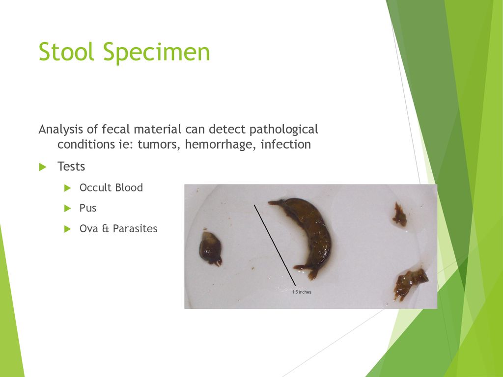 Stool Specimen Analysis of fecal material can detect pathological conditions ie: tumors, hemorrhage, infection.