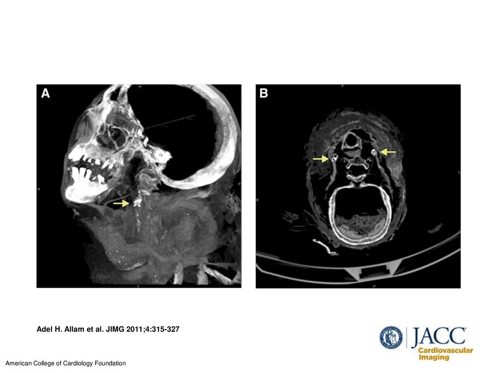 Adel H. Allam et al. JIMG 2011;4: - ppt download